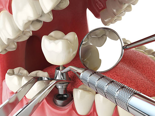 Best Emergency Dental Care for Trauma or Injury in Landen, OH